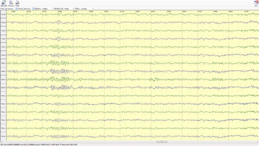 Viewing software / EEG Neuron-Spectrum-Viewer Neurosoft