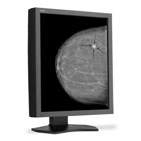 LCD display / diagnostic / medical imaging 5 MP | MD215MG NEC