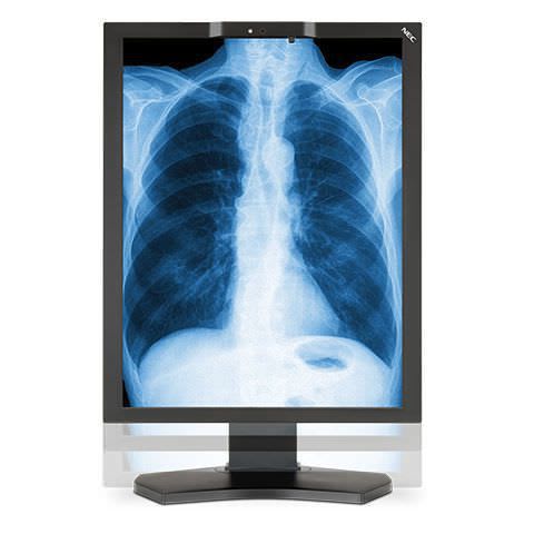 LCD display / diagnostic / medical imaging 2 MP | MD210C3 NEC