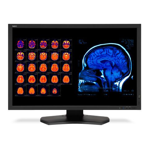 LCD display / medical 30 " | MD301C4 NEC
