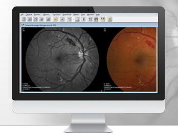 Ophthalmology computer workstation / medical Merge Eye Station™ MERGE Healthcare