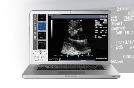 Reporting software / analysis / medical / for cardiology Merge Cardio™ MERGE Healthcare