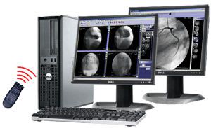 Medical computer workstation / for catheterization laboratory CathView Millensys