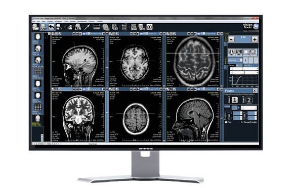 Medical computer workstation / medical imaging / for PACS Vision Tools MultiView Millensys