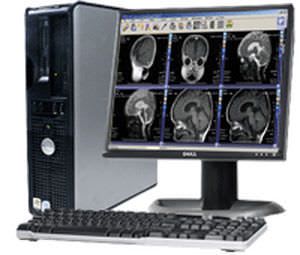 CT computer workstation / MRI / for anatomical imaging / medical MRview Millensys