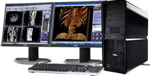 CT computer workstation / MRI / for anatomical imaging / medical CTview Millensys