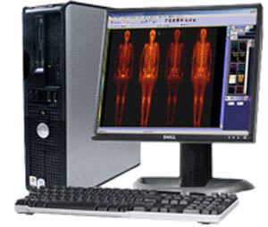 Medical computer workstation / nuclear medicine GView Millensys