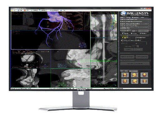 Diagnostic software / 3D viewing / medical imaging / medical Vision Tools 3DView Millensys