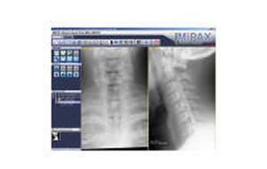 Viewing software / medical / for DICOM files MiViewer Millensys