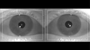 Videonystagmoscope vestibular disorder testing system VisualEyes™ Micromedical Technologies