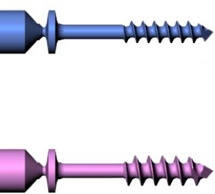 Forefoot osteotomy cannulated bone screw / not absorbable ø 2.0 - 2.7 mm Lima Corporate