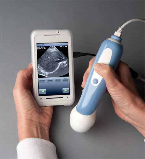 Hand-held ultrasound system / for multipurpose ultrasound imaging / all-in-one probe MobiUS™ SP1 MobiSante