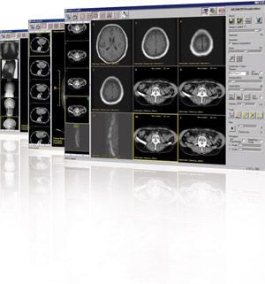 Viewing software / for archiving / data exchange / medical imaging VIMED® DICOM-COOP MEYTEC