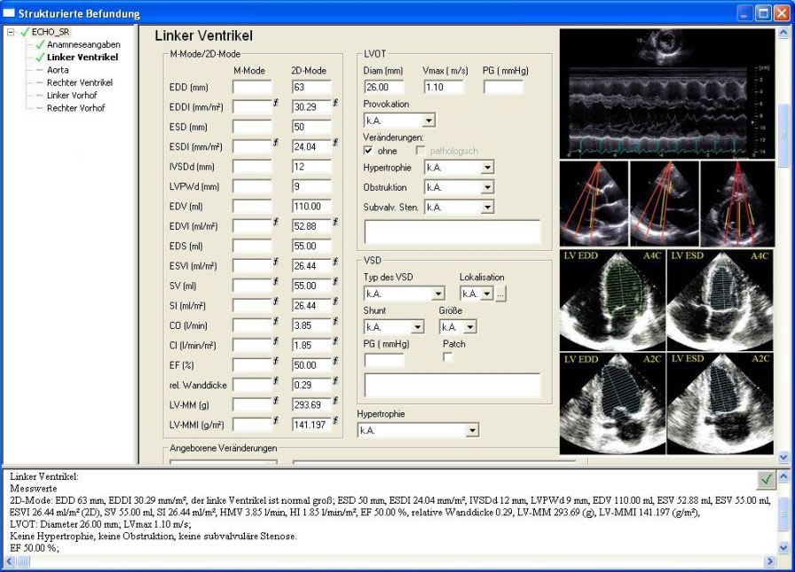 Reporting software / cardiology / medical / echocardiography Echo SR meso international