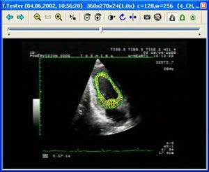 Reporting software / diagnostic / medical / cardiology Stressecho meso international