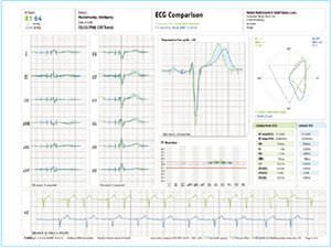 Electrocardiography software / medical PADSY-ECG Medset Medizintechnik