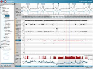 3-channels cardiac Holter monitor TELESMART Medset Medizintechnik