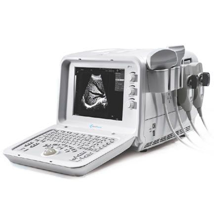 Portable ultrasound system / for multipurpose ultrasound imaging P1 MediSono