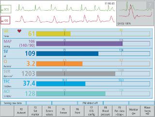 Cardiac output monitor Niccomo medis Medizinische Messtechnik