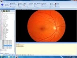 Management software / ophthalmology / medical Medmont DV200 Medmont
