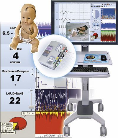 EEG patient monitor / infant Encephalan-CFM Medicom MTD