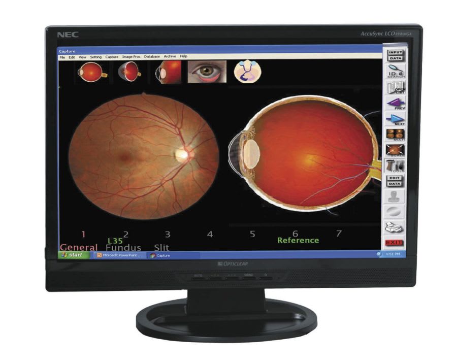 Diagnostic software / viewing / ophthalmology / medical VK-2 Kowa American Corporation