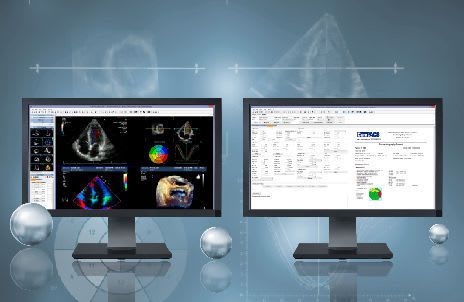Analysis software / reporting / medical / cardiology Echo MediMatic