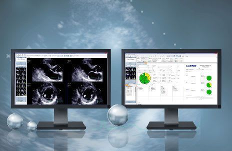 Analysis software / ECG / medical / cardiology Stress Echo MediMatic