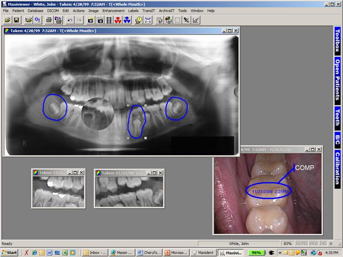 Dental imaging software / medical MaxiViewer™ Maxident