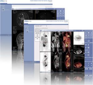 Clinical trial management software IMAGYS KEOSYS