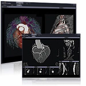 Diagnostic software / 3D viewing / medical / cardiology Xelis INFINITT NORTH AMERICA