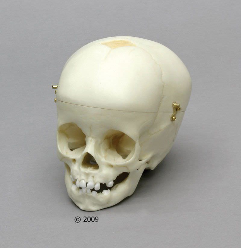 Skull anatomical model / child / articulated 4770 Erler-Zimmer Anatomiemodelle