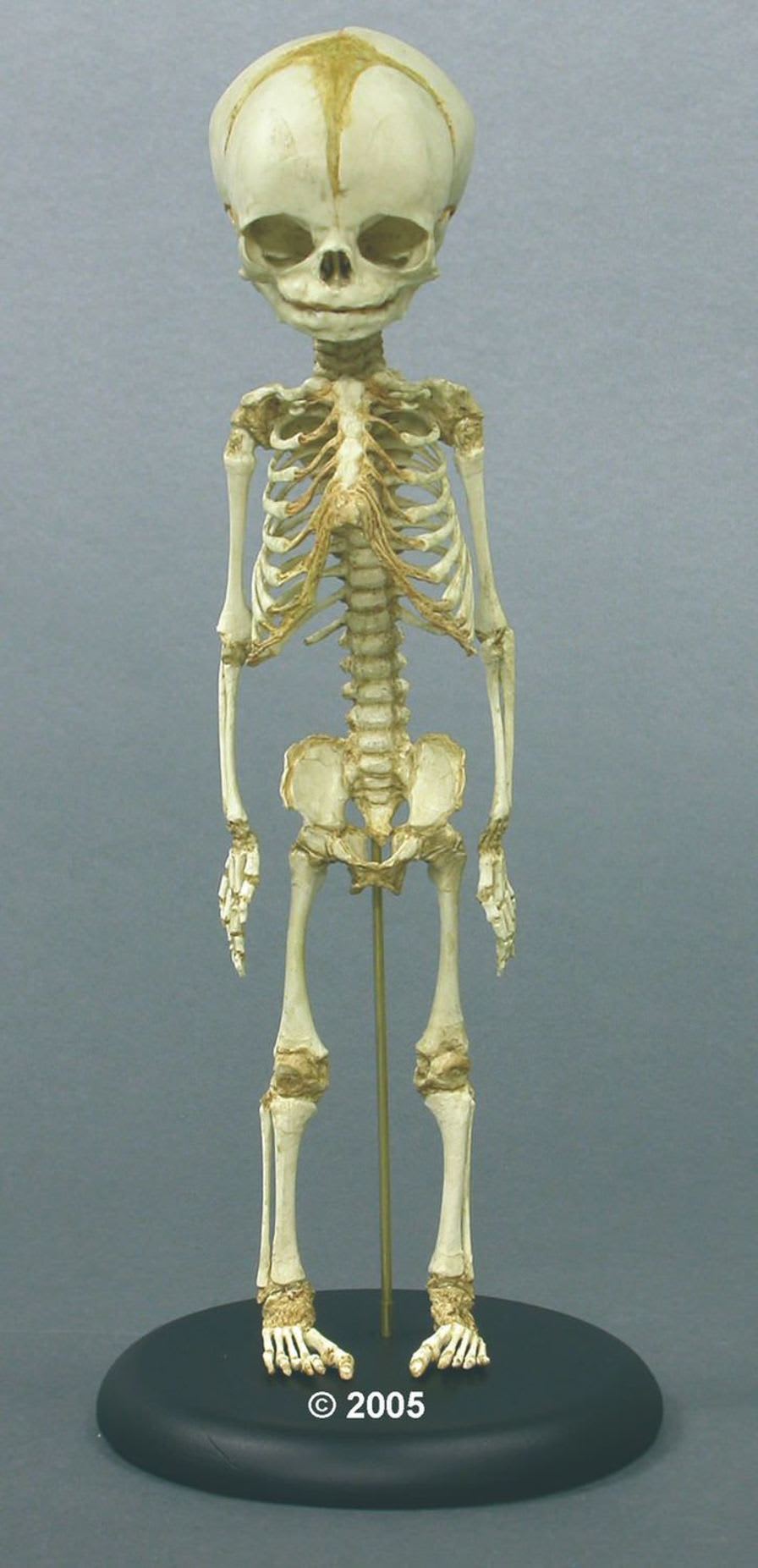 Skeleton anatomical model / fetus / articulated 2850 Erler-Zimmer Anatomiemodelle