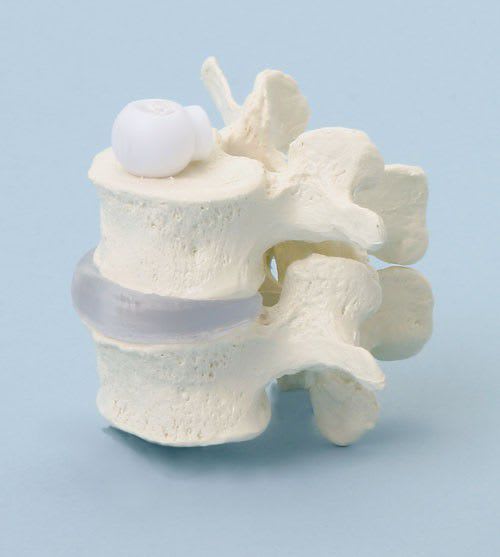 Lumbar vertebra anatomical model 4090 Erler-Zimmer Anatomiemodelle