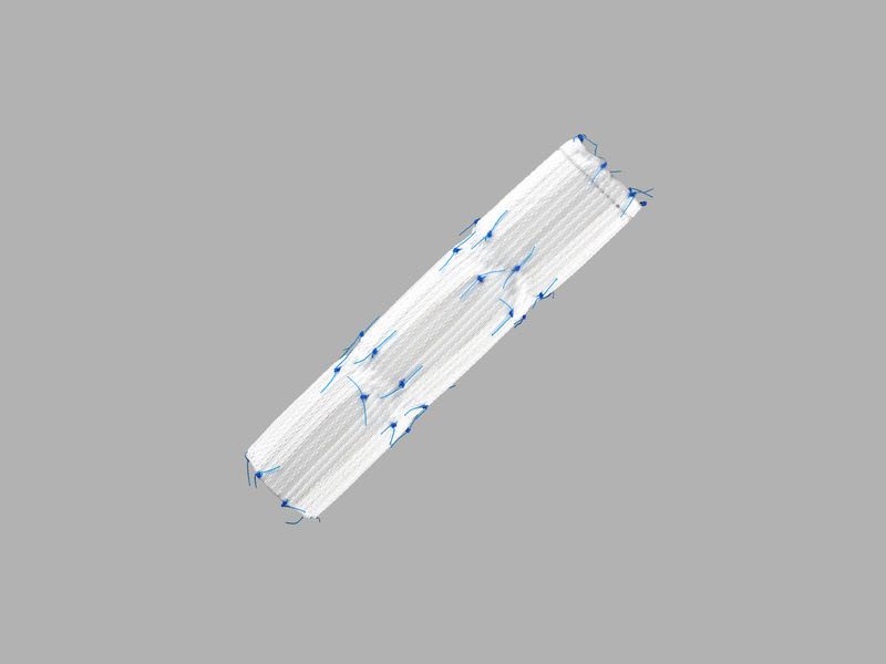 Abdominal stent graft / endovascular / stainless steel 14 - 16 F | Zenith Flex® AAA series COOK Medical