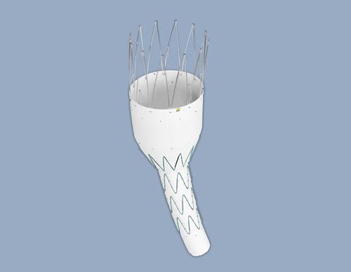 Abdominal stent graft / stainless steel 18 - 22 F | Zenith® Renu™ AAA Converter series COOK Medical