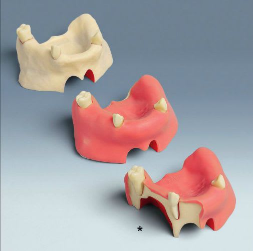 Denture anatomical model A-J F SOK | A-J F SOKW frasaco