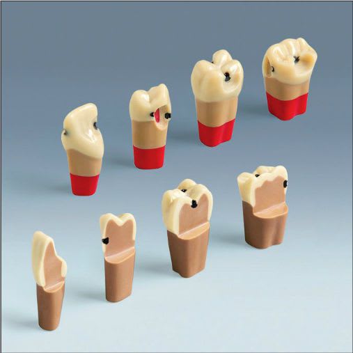Tooth pathology anatomical model ANA-4 ZSDPK frasaco
