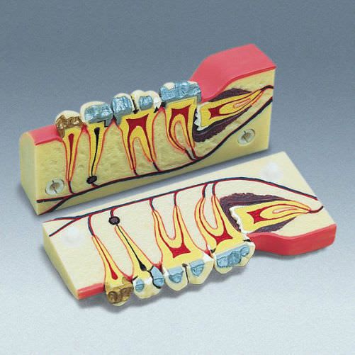 Denture anatomical model D-5 frasaco