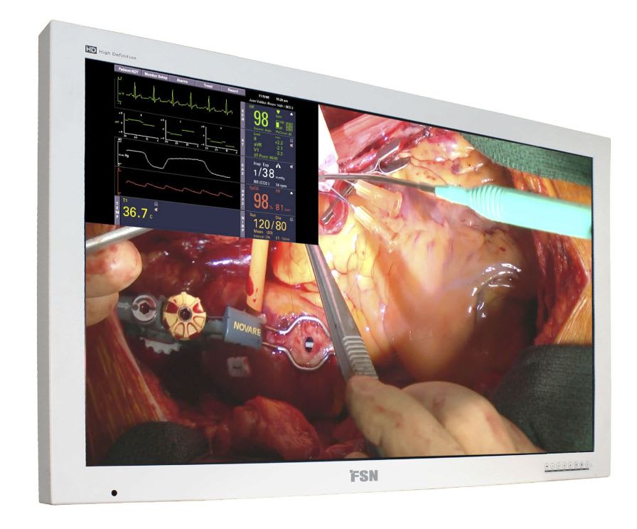 LCD display / high-definition / endoscopy / surgical FS-L5501D FSN Medical Technologies