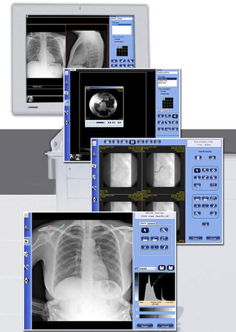 Viewing software / conditioning / acquisition / medical imaging DELUXE General Medical Italia