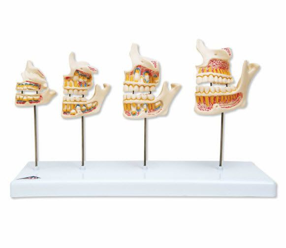 Denture anatomical model D20 3B Scientific