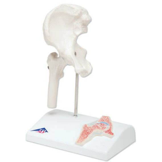 Hip anatomical model / joints / miniature A84/1 3B Scientific