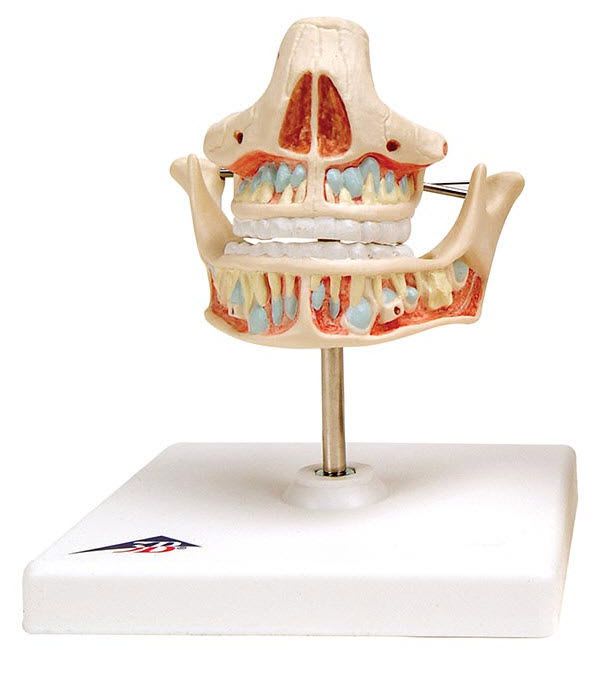 Denture anatomical model VE281 3B Scientific