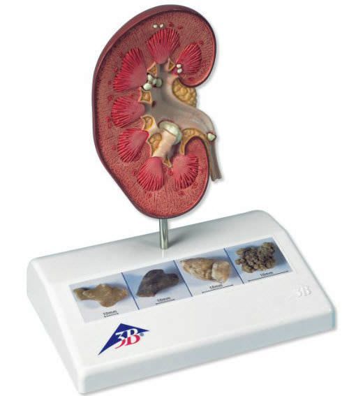 Kidney anatomical model K29 3B Scientific