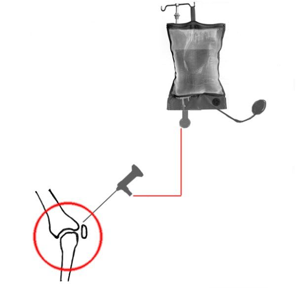 Veterinary pressure infusion cuff AR-08-100 Dr. Fritz GmbH