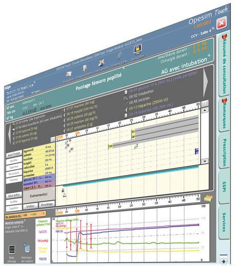 Management software / for anesthesia services / medical Opesim Touch EVOLUCARE