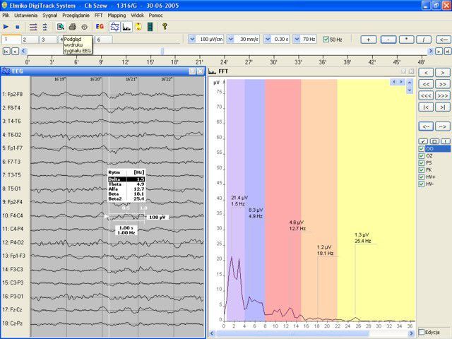EEG software / medical EEG DigiTrack ELMIKO Medical Equipment