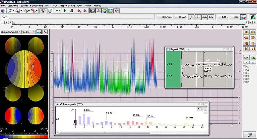 EEG patient monitor CFM ELMIKO Medical Equipment