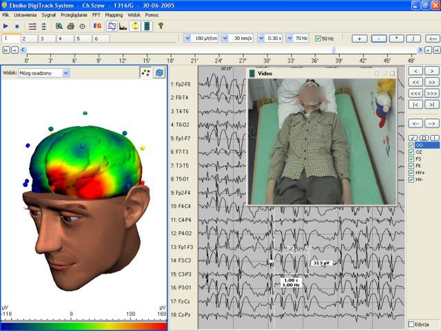 Electroencephalograph EEG DigiTrack ELMIKO Medical Equipment